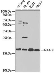 Anti-NAT13 antibody used in Western Blot (WB). GTX65849