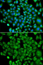 Anti-NAT13 antibody used in Immunocytochemistry/ Immunofluorescence (ICC/IF). GTX65849