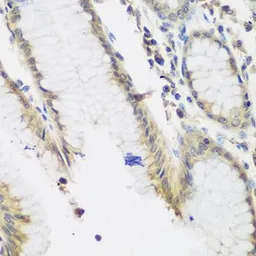 Anti-NAT13 antibody used in IHC (Paraffin sections) (IHC-P). GTX65849