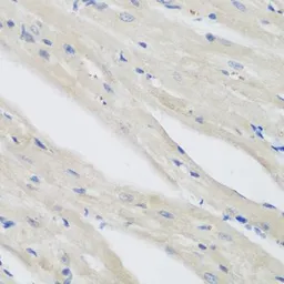 Anti-NAT13 antibody used in IHC (Paraffin sections) (IHC-P). GTX65849