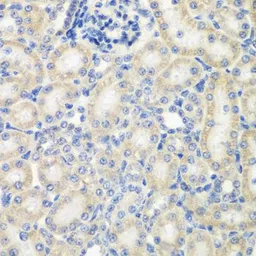 Anti-NAT13 antibody used in IHC (Paraffin sections) (IHC-P). GTX65849