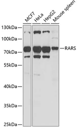Anti-Arginyl tRNA synthetase antibody used in Western Blot (WB). GTX65850