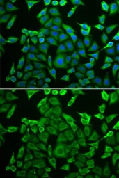 Anti-Arginyl tRNA synthetase antibody used in Immunocytochemistry/ Immunofluorescence (ICC/IF). GTX65850