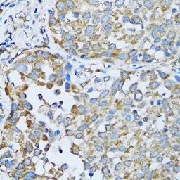 Anti-Arginyl tRNA synthetase antibody used in IHC (Paraffin sections) (IHC-P). GTX65850