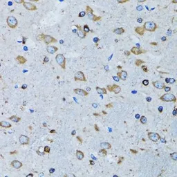 Anti-Arginyl tRNA synthetase antibody used in IHC (Paraffin sections) (IHC-P). GTX65850