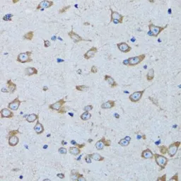 Anti-Arginyl tRNA synthetase antibody used in IHC (Paraffin sections) (IHC-P). GTX65850