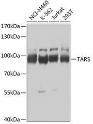Anti-ThrRS antibody used in Western Blot (WB). GTX65852