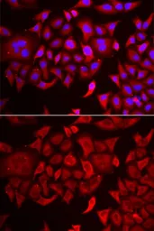 Anti-ThrRS antibody used in Immunocytochemistry/ Immunofluorescence (ICC/IF). GTX65852