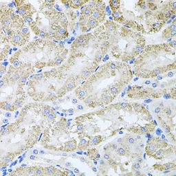 Anti-ThrRS antibody used in IHC (Paraffin sections) (IHC-P). GTX65852