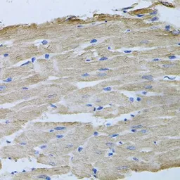 Anti-ThrRS antibody used in IHC (Paraffin sections) (IHC-P). GTX65852
