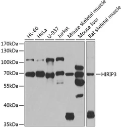 Anti-HIRIP3 antibody used in Western Blot (WB). GTX65853
