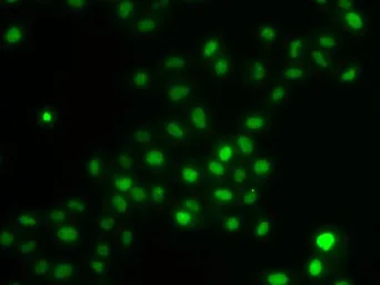 Anti-HIRIP3 antibody used in Immunocytochemistry/ Immunofluorescence (ICC/IF). GTX65853