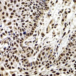 Anti-HIRIP3 antibody used in IHC (Paraffin sections) (IHC-P). GTX65853