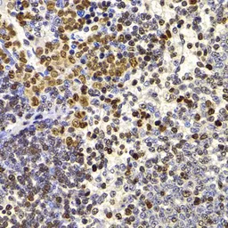 Anti-HIRIP3 antibody used in IHC (Paraffin sections) (IHC-P). GTX65853