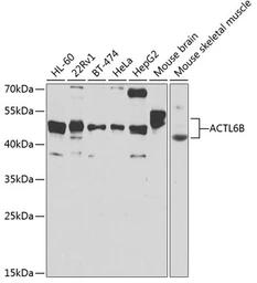 Anti-BAF53B antibody used in Western Blot (WB). GTX65855