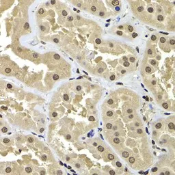 Anti-BAF53B antibody used in IHC (Paraffin sections) (IHC-P). GTX65855