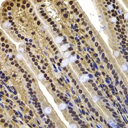 Anti-BAF53B antibody used in IHC (Paraffin sections) (IHC-P). GTX65855