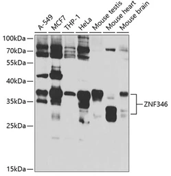 Anti-ZNF346 antibody used in Western Blot (WB). GTX65857