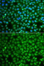 Anti-ZNF346 antibody used in Immunocytochemistry/ Immunofluorescence (ICC/IF). GTX65857