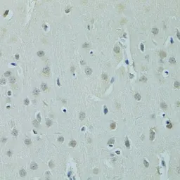 Anti-ZNF346 antibody used in IHC (Paraffin sections) (IHC-P). GTX65857