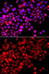 Anti-CoCoA antibody used in Immunocytochemistry/ Immunofluorescence (ICC/IF). GTX65858