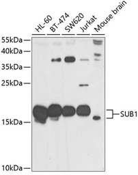 Anti-PC4 antibody used in Western Blot (WB). GTX65860