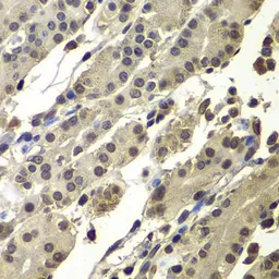 Anti-PC4 antibody used in IHC (Paraffin sections) (IHC-P). GTX65860