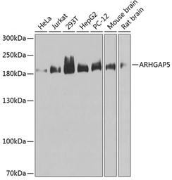 Anti-p190-B RhoGAP antibody used in Western Blot (WB). GTX65862