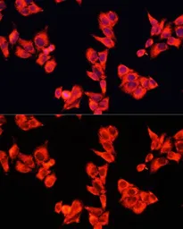 Anti-p190-B RhoGAP antibody used in Immunocytochemistry/ Immunofluorescence (ICC/IF). GTX65862