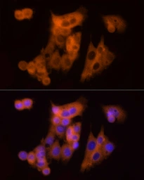Anti-CLIC1 antibody used in Immunocytochemistry/ Immunofluorescence (ICC/IF). GTX65866