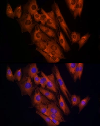 Anti-CLIC1 antibody used in Immunocytochemistry/ Immunofluorescence (ICC/IF). GTX65866