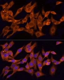 Anti-CLIC1 antibody used in Immunocytochemistry/ Immunofluorescence (ICC/IF). GTX65866