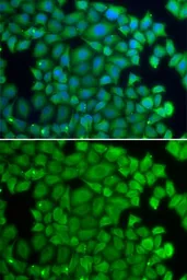 Anti-HSPB2 antibody used in Immunocytochemistry/ Immunofluorescence (ICC/IF). GTX65869