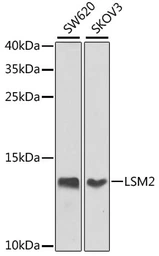 Anti-LSM2 antibody used in Western Blot (WB). GTX65872