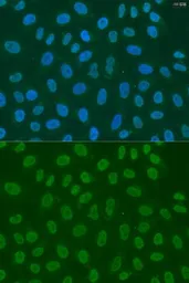 Anti-LSM2 antibody used in Immunocytochemistry/ Immunofluorescence (ICC/IF). GTX65872