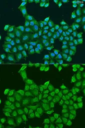 Anti-ATP5O antibody used in Immunocytochemistry/ Immunofluorescence (ICC/IF). GTX65873