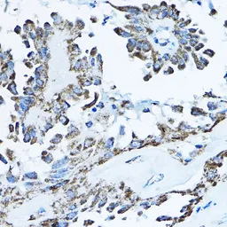 Anti-ATP5O antibody used in IHC (Paraffin sections) (IHC-P). GTX65873