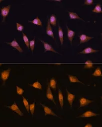 Anti-MyoD1 antibody used in Immunocytochemistry/ Immunofluorescence (ICC/IF). GTX65875