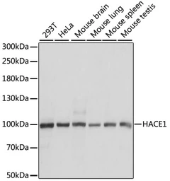 Anti-HACE1 antibody used in Western Blot (WB). GTX65876