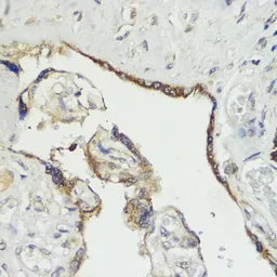 Anti-HACE1 antibody used in IHC (Paraffin sections) (IHC-P). GTX65876