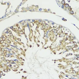 Anti-HACE1 antibody used in IHC (Paraffin sections) (IHC-P). GTX65876