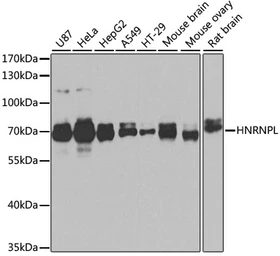 Anti-hnRNP L antibody used in Western Blot (WB). GTX65879