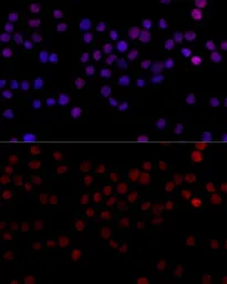 Anti-hnRNP L antibody used in Immunocytochemistry/ Immunofluorescence (ICC/IF). GTX65879