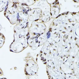 Anti-hnRNP L antibody used in IHC (Paraffin sections) (IHC-P). GTX65879
