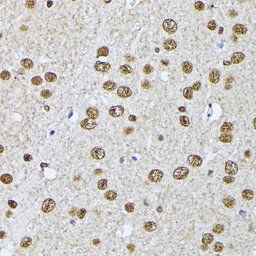 Anti-hnRNP L antibody used in IHC (Paraffin sections) (IHC-P). GTX65879