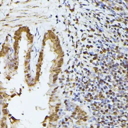 Anti-hnRNP L antibody used in IHC (Paraffin sections) (IHC-P). GTX65879
