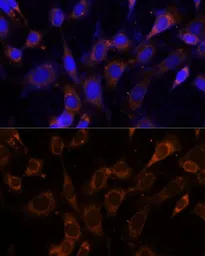 Anti-VPS25 antibody used in Immunocytochemistry/ Immunofluorescence (ICC/IF). GTX65881