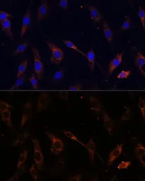 Anti-VPS25 antibody used in Immunocytochemistry/ Immunofluorescence (ICC/IF). GTX65881
