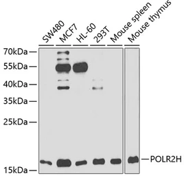Anti-RPB8 antibody used in Western Blot (WB). GTX65882