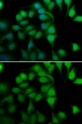 Anti-RPB8 antibody used in Immunocytochemistry/ Immunofluorescence (ICC/IF). GTX65882